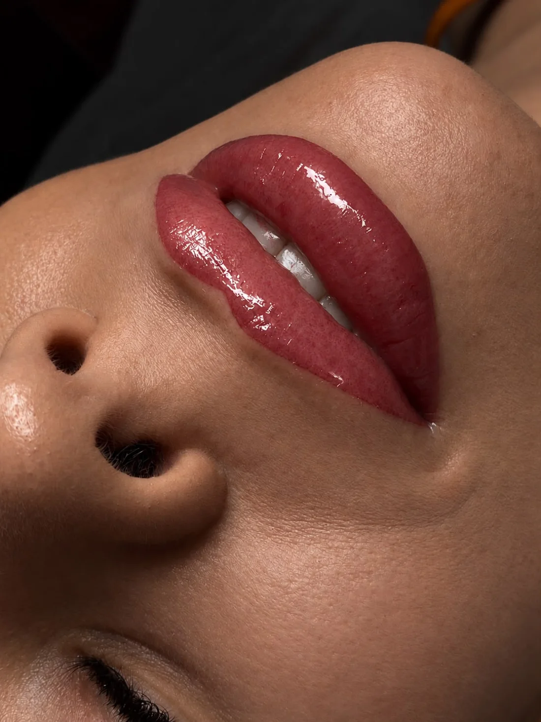 Modelowanie ust Piła — Dominika — efekt zabiegu 1, Beauty Station Piła