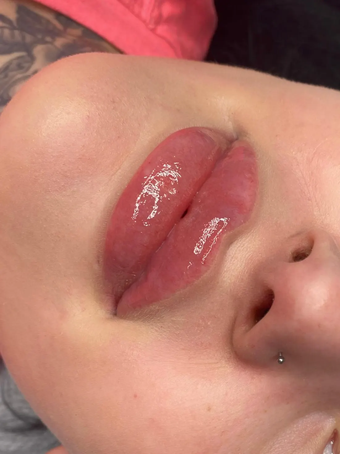 Modelowanie ust Piła — Dominika — efekt zabiegu 1, Beauty Station Piła
