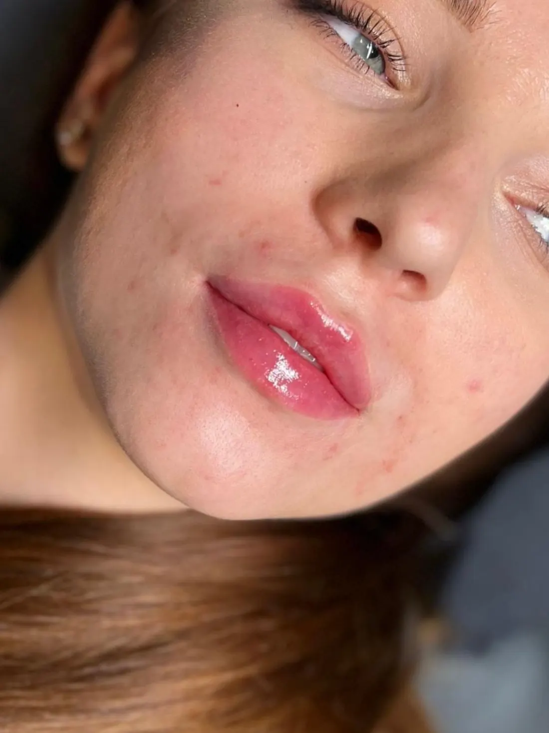 Modelowanie ust Piła — Dominika — efekt zabiegu 2, Beauty Station Piła