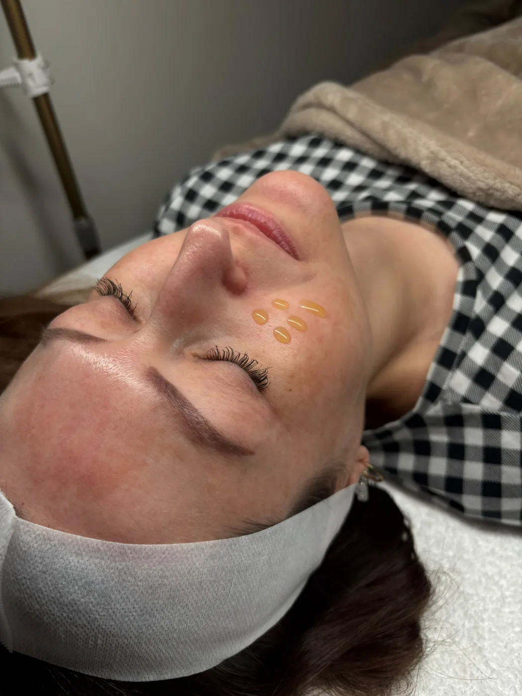 Peeling PQ Age Piła — Justyna — efekt zabiegu 3, Beauty Station Piła